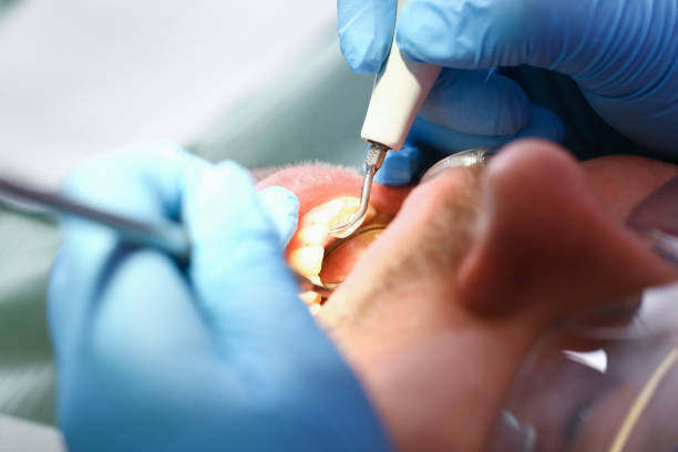 Emergency Dentist Open Today in VA